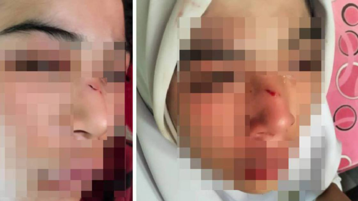 Kelantan Education Authorities Launch Investigation into Alleged Student Assault