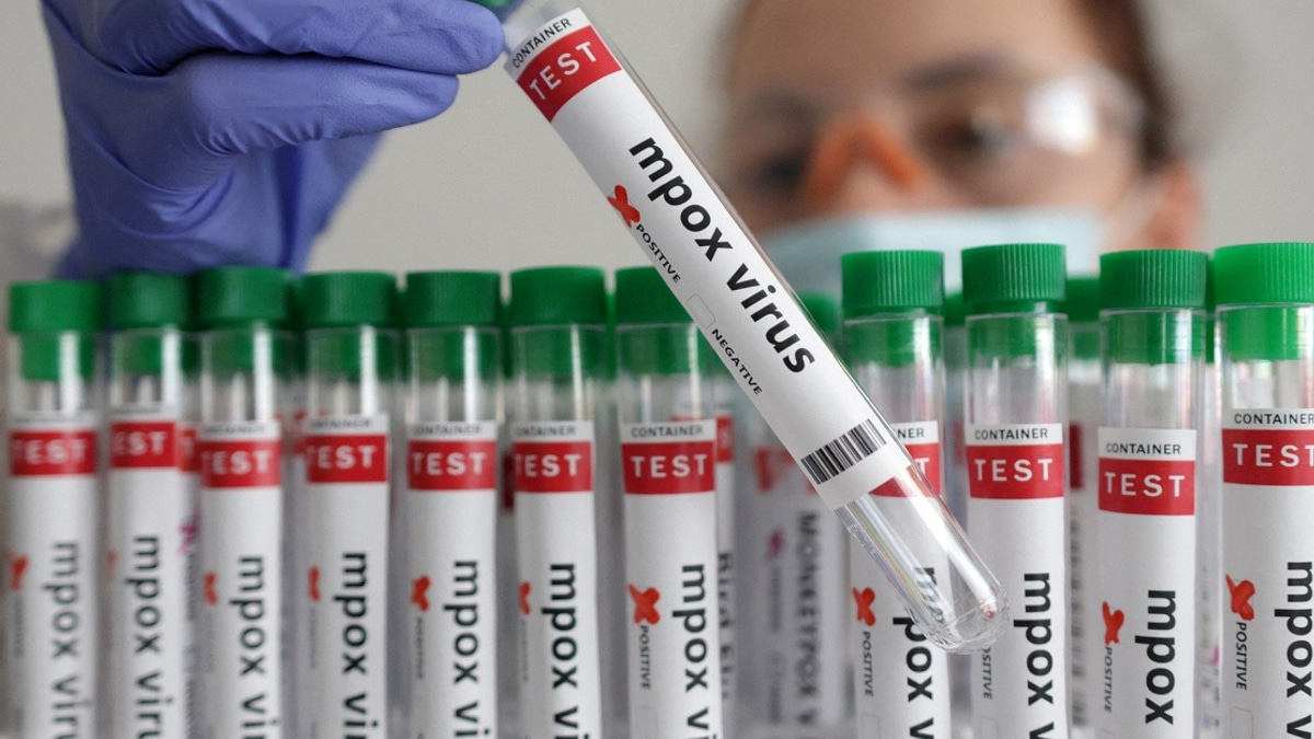 Guinea-Bissau Reports First Mpox Case, Triggers Health Alert