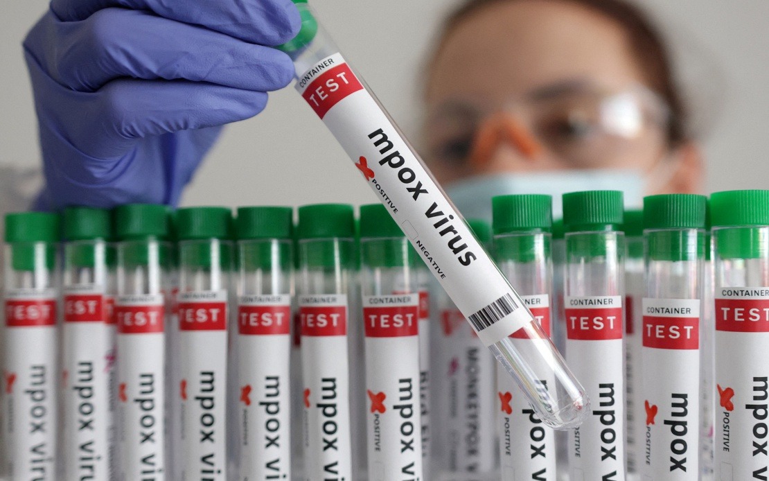 Guinea-Bissau Reports First Mpox Case, Triggers Health Alert