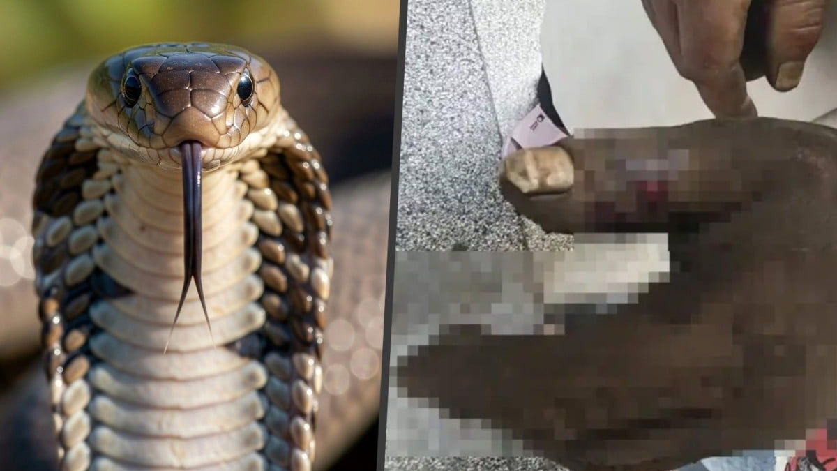 Cobra Bite in China Teaches Costly Lesson: Why Sucking Out Snake Venom Is Deadly