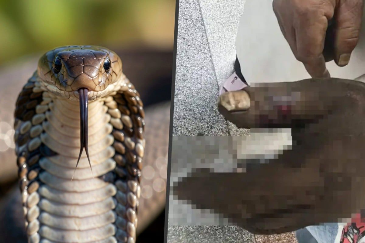 Cobra Bite in China Teaches Costly Lesson: Why Sucking Out Snake Venom Is Deadly