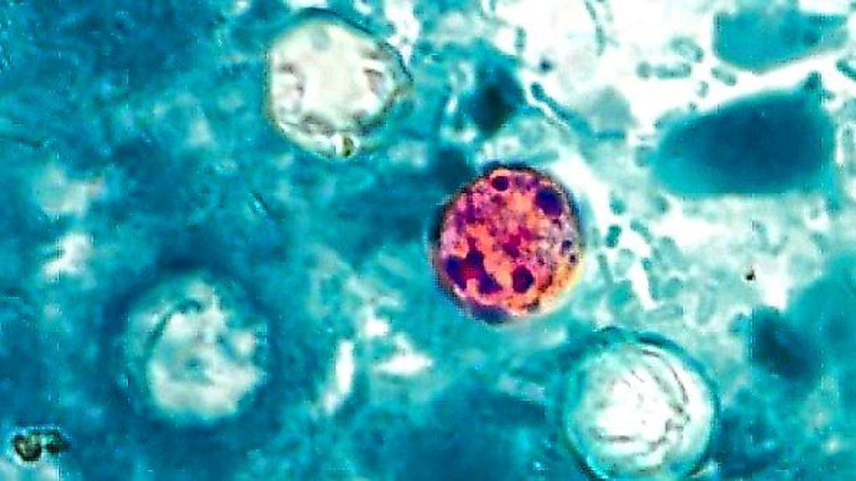 The Perfect Hide: Why Cyclospora Outbreaks Remain Elusive for Food Safety Investigators