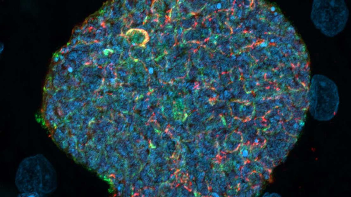 Australian Researchers Develop Malaria Prevention Strategy Using Mosquito Bites as Natural Immune Boosters