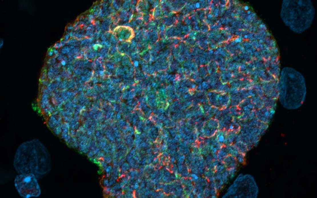 Australian Researchers Develop Malaria Prevention Strategy Using Mosquito Bites as Natural Immune Boosters