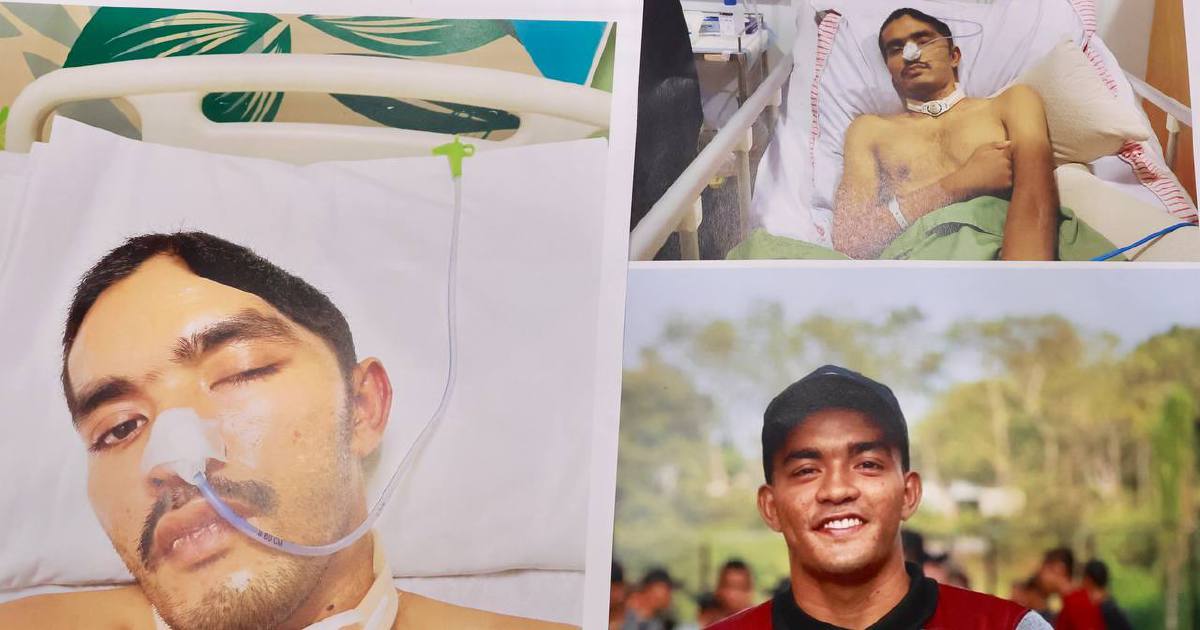 Malaysian Army Concludes Investigation into Johor Camp Commando Injury; Dismissals to Follow